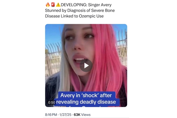 Ozempic Causing Osteoporosis in Young People?